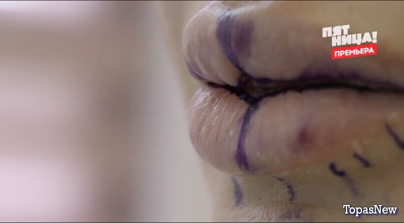 Что я наделала?! 1 серия 13 января 2026 бесплатно